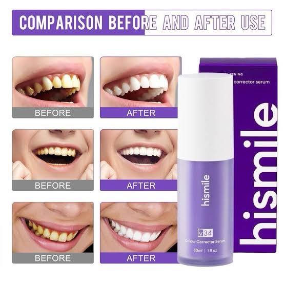 Hismile V34 Colour Corrector Serum 30ml - Image 5